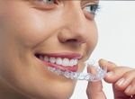 Invisalign braces