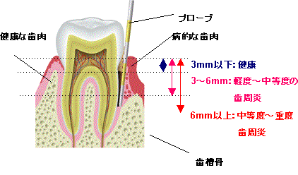 インプラント治療を行うための診査2