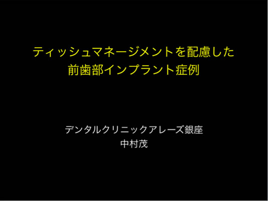 ティッシュマネージメントを配慮した前歯部インプラント症例01