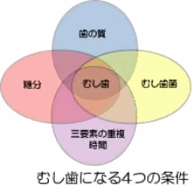 むし歯になる4つの条件