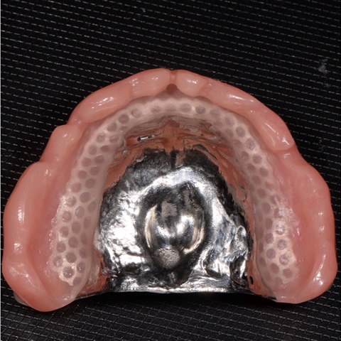 当院の入れ歯治療における特徴