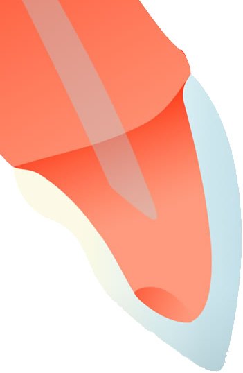 神経を残すことにより様々なメリットがあります。