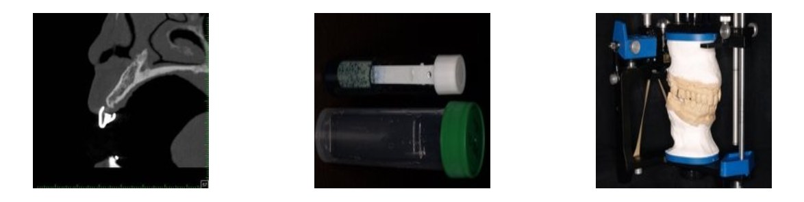 精密検査