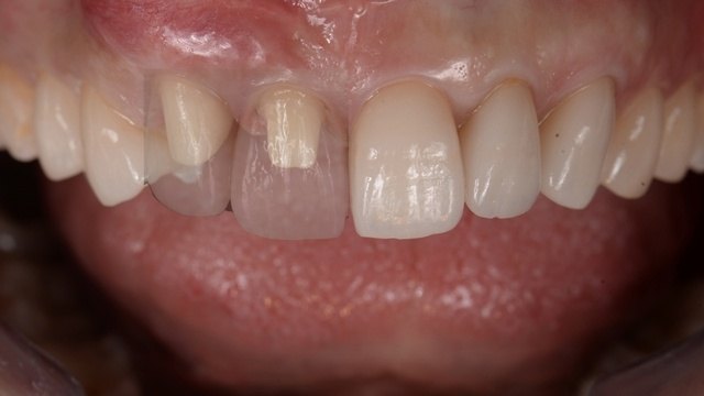 当院における毛髪ミネラル検査と栄養指導の特徴